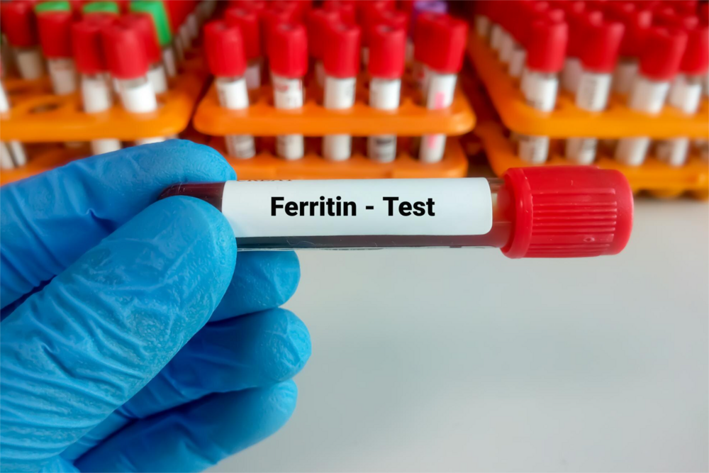 FERRITINA