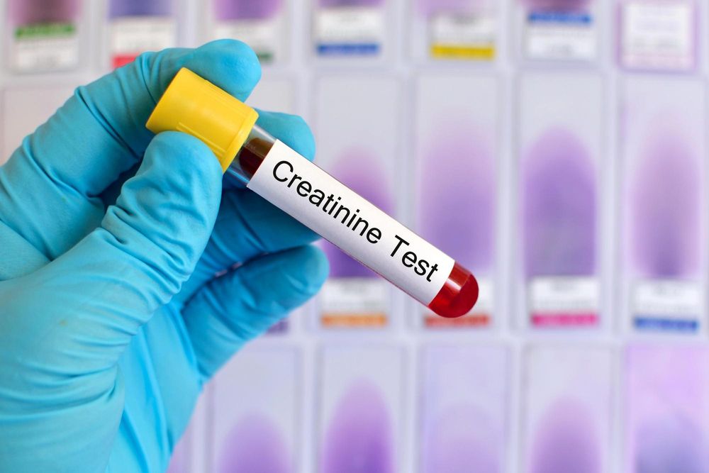 ACLARAMIENTO DE CREATININA