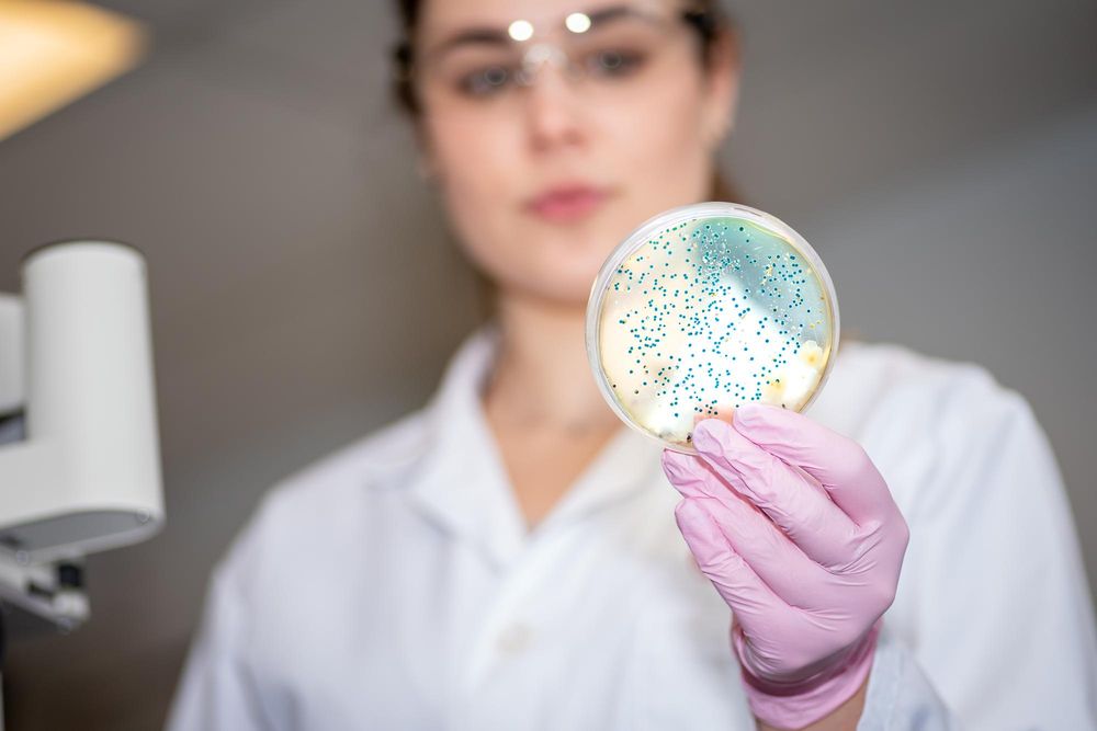 CITOPLASMA NEUTROFILOS AC. (ANCA)
