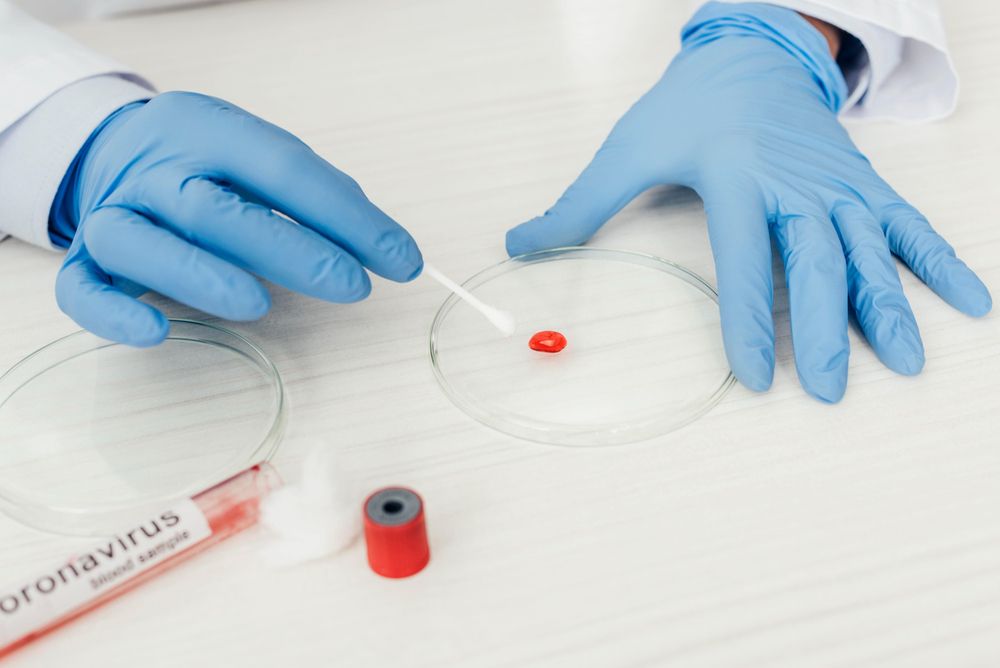 HLA-C TIPAJE EN SANGRE